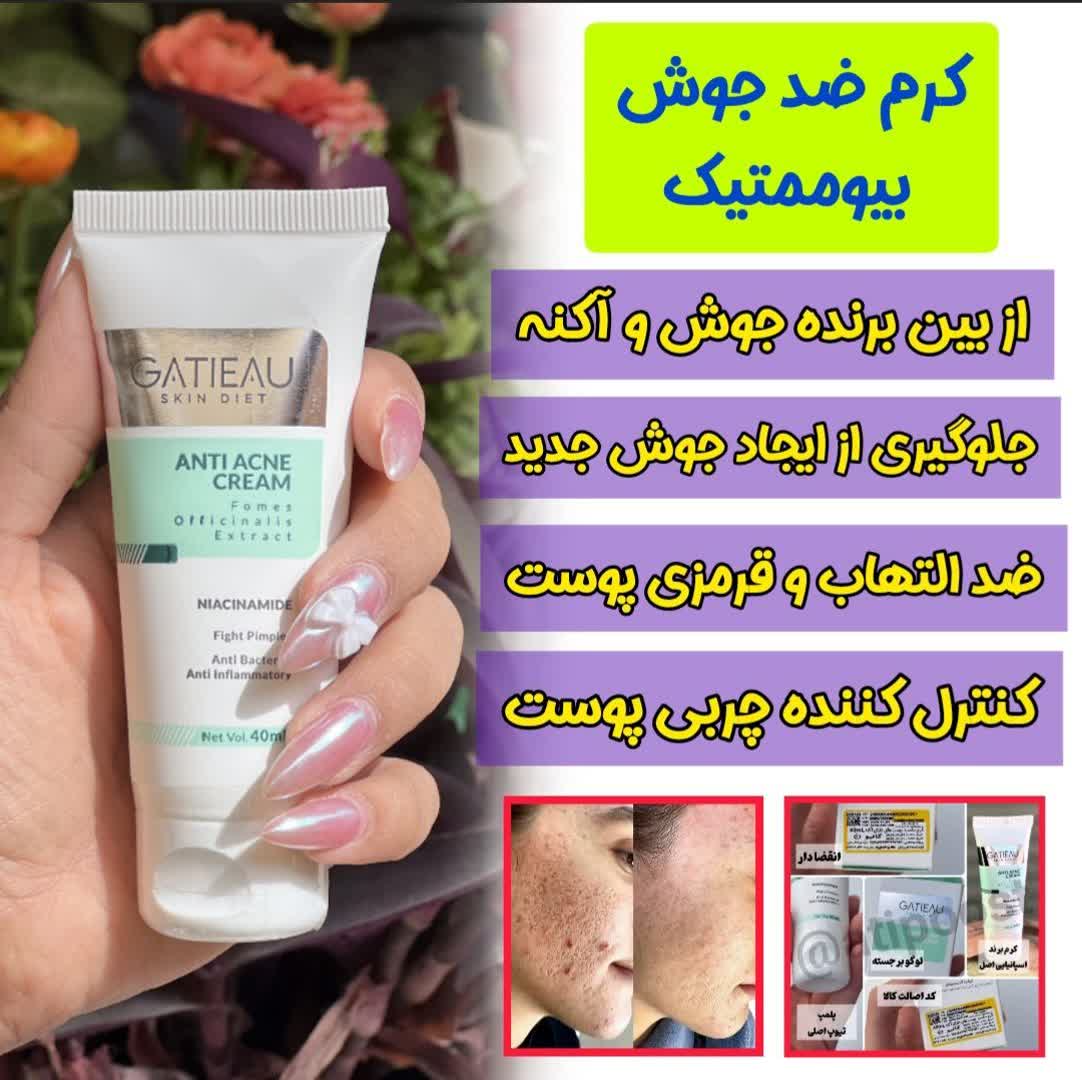 قویترین کرم ضد جوش و لک برند گاتیو ایتالیا اورجینال